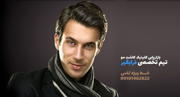 بازاریابی کلینیک کاشت مو