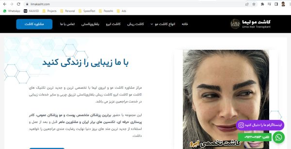 مرکز کاشت مو لیما