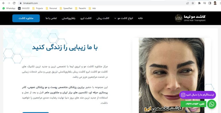 طراحی سایت مرکز کاشت لیما 4 مرکز کاشت مو لیما