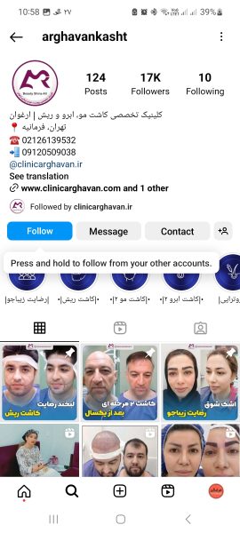 ادمین اینستاگرام مرکز کاشت مو