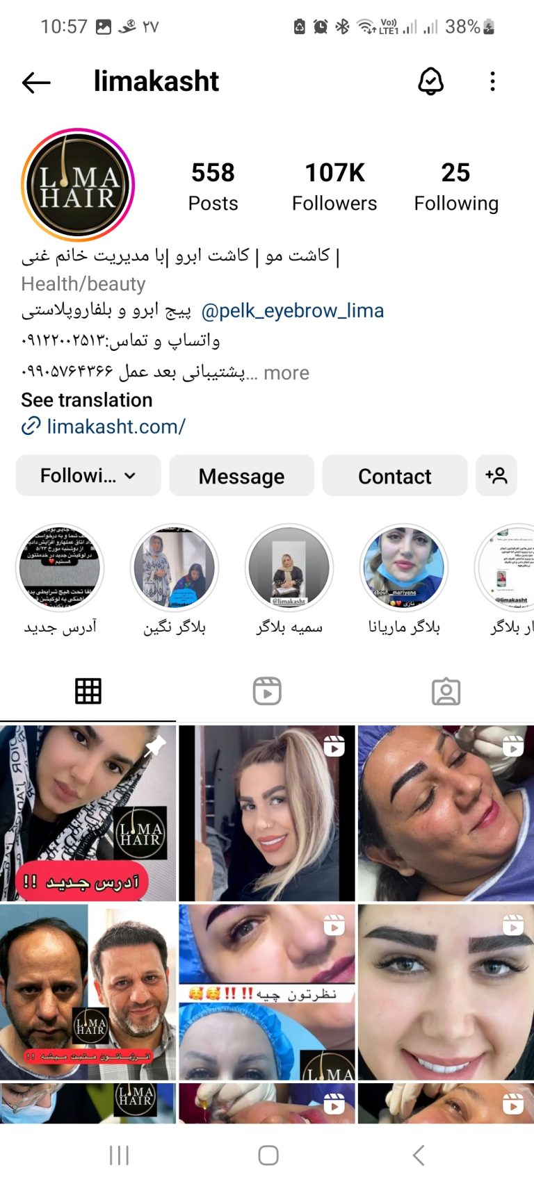 کلینیک کاشت مو لیماکاشت 1 ادمين اینستاگرام کلینیک کاشت مو