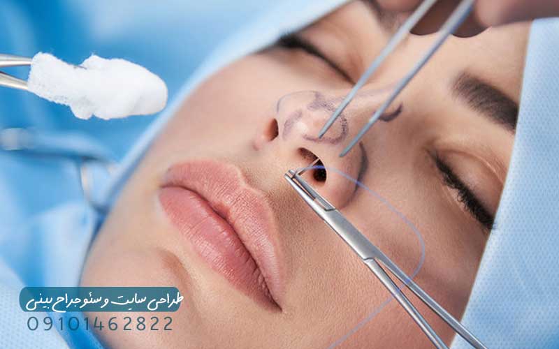 طراحی سایت و سئو جراح بینی