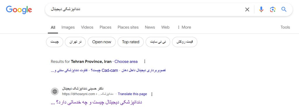 نمونه پروژه سئو 6 متخصص سئو نمونه لینک 1 گوگل