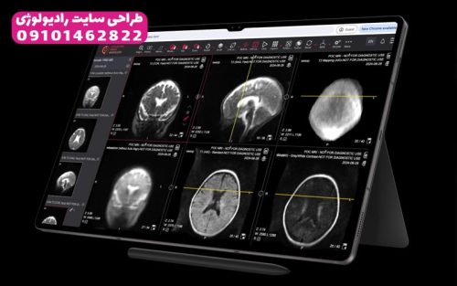 طراحی سایت رادیولوژی