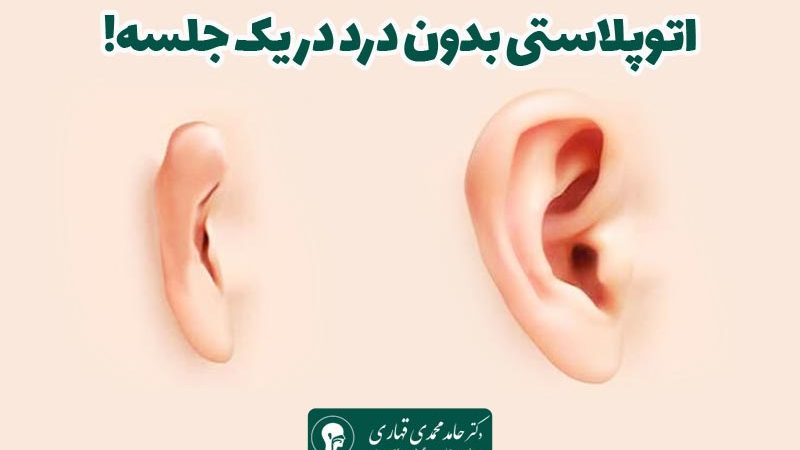 اتوپلاستی بدون درد