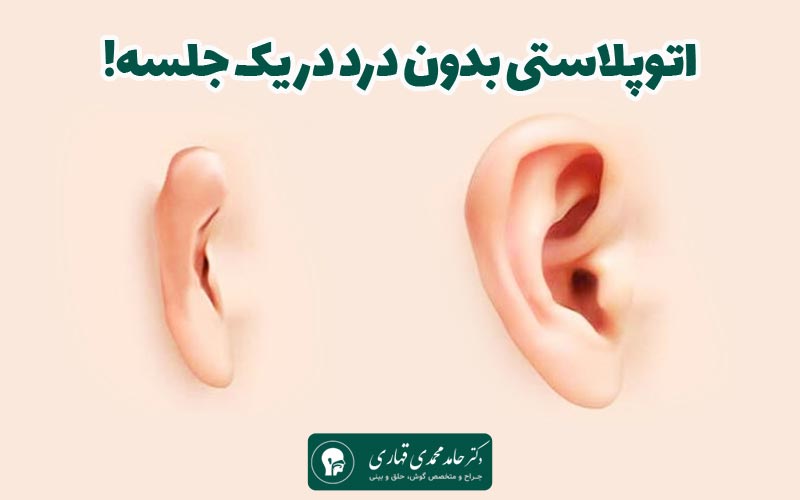 اتوپلاستی بدون درد 4 اتوپلاستی بدون درد