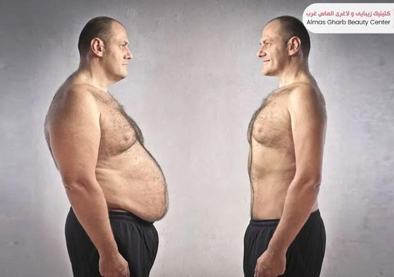 هزینه لاغری با دستگاه در غرب تهران